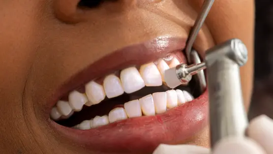 توطين طب الأسنان في السعودية يدخل مرحلته الثانية بنسبة 55%